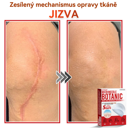 💖GFOUK® Mikrojehličková botanická náplast na odstranění bradavic
