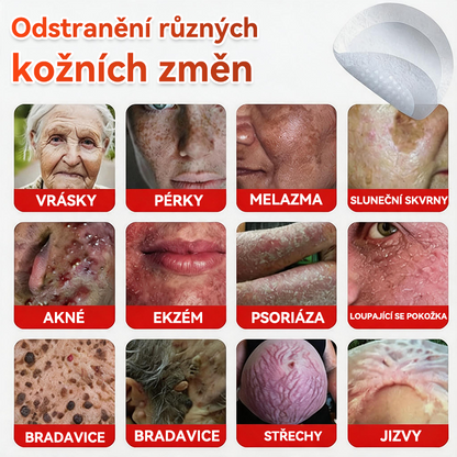 💖GFOUK® Mikrojehličková botanická náplast na odstranění bradavic